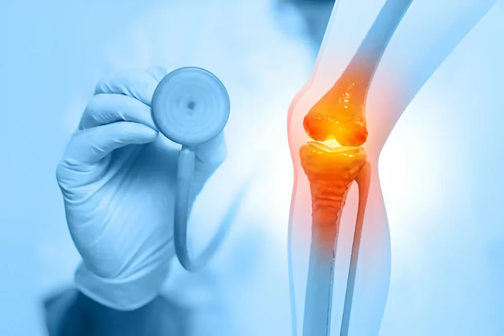 Orthopedic Care: A Guide to Healthy Joints, Bones, and Muscles