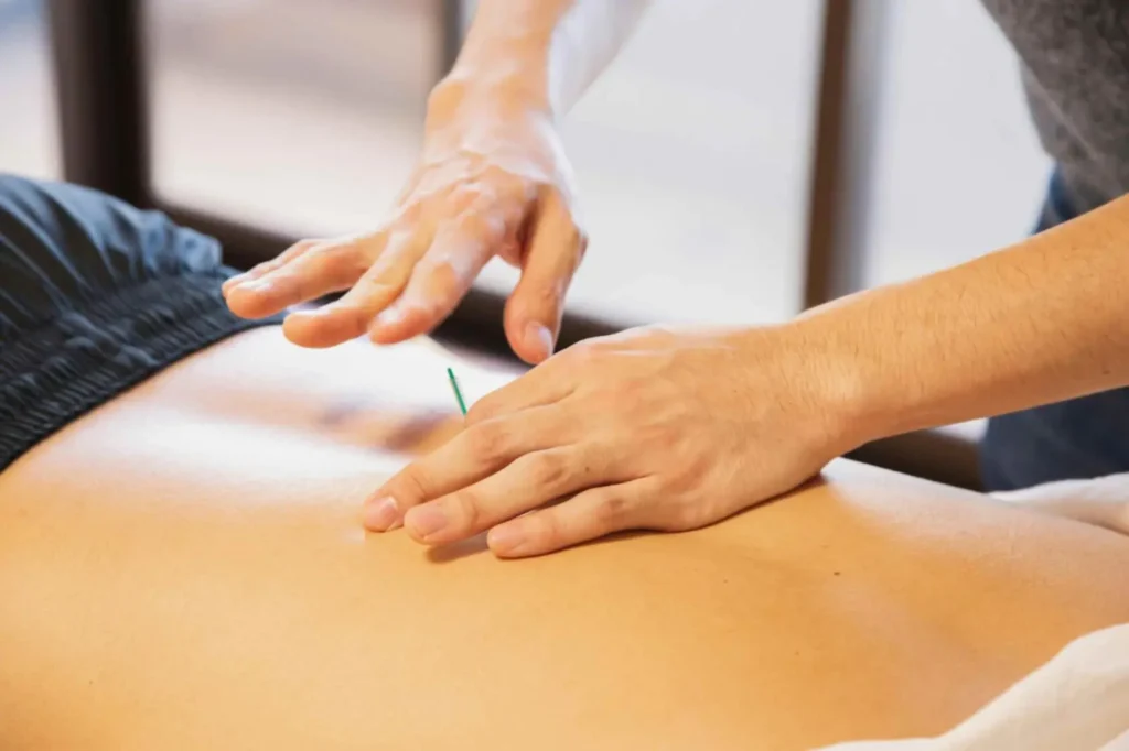 Acupuncture as a Supportive Therapy for Pain and Stress