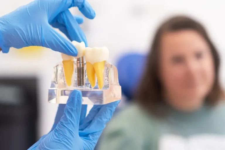 6 Tips For Caring For Your Gums And Implants Long Term