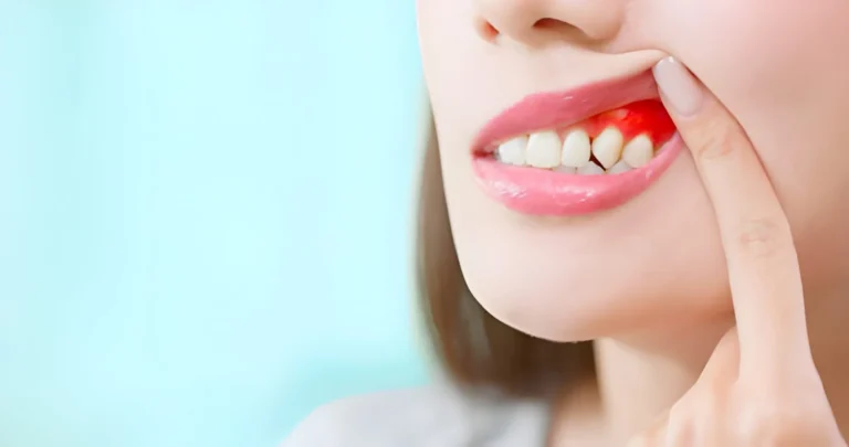 4 Common Treatments For Gum Disease Explained