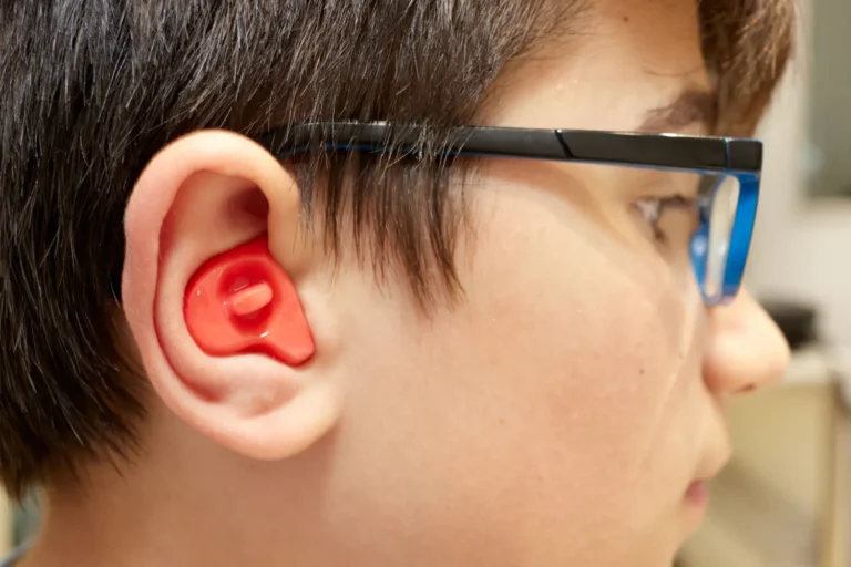 The  Role Of Ear Molds in Great Hearing