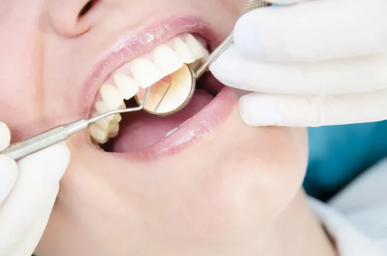 4 Benefits Of Scheduling Preventive Dentistry Visits On Time